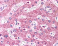 ARP51375_P050 - HNF1 alpha / TCF1