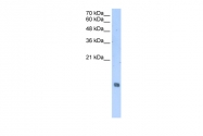 ARP51481_T100 - Histone H2A type 2-A