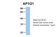 ARP51923_P050 - AP1 complex subunit gamma-1 / AP1G1
