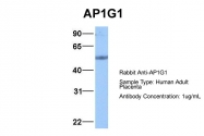 ARP51923_P050 - AP1 complex subunit gamma-1 / AP1G1