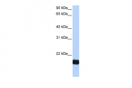 ARP51943_P050 - Cardiotrophin-1