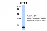 ARP51943_P050 - Cardiotrophin-1