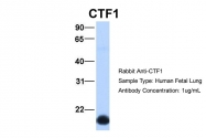 ARP51943_P050 - Cardiotrophin-1