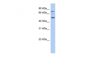 ARP51987_P050 - Casein kinase I epsilon