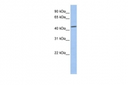 ARP51990_P050 - Casein kinase II subunit alpha