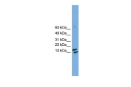 ARP52154_P050 - Cyclophilin H / PPIH