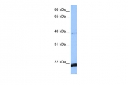 ARP52212_P050 - HBS1-like protein