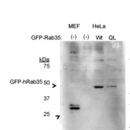 ARP52268_P050 - RAB35 / RAB1C