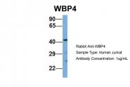 ARP52293_P050 - WBP4