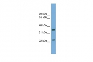 ARP52298_P050 - WIF1