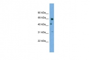 ARP52311_P050 - PNKP