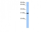 ARP52341_P050 - Peroxiredoxin-3 / PRDX3