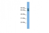 ARP52396_P050 - DAB1