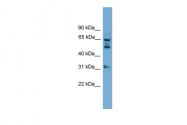 ARP52794_P050 - WDR16 / WDRPUH
