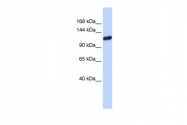ARP52960_P050 - PIWIL4