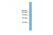 ARP52961_P050 - PIWIL4