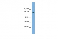 ARP53264_P050 - MCMDC2 / C8orf45