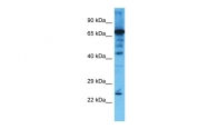 ARP53339_P050 - CHMP4B