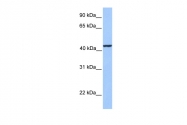 ARP53346_P050 - Kinesin light chain 3