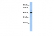 ARP53431_P050 - THAP5