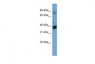 ARP53530_P050 - Sideroflexin-4 (SFXN4)