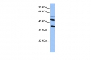 ARP53558_P050 - CD213a2 / IL13RA2