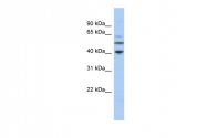 ARP53649_P050 - alpha Tubulin / TUBA3C / TUBA2