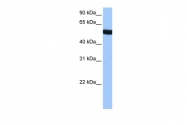 ARP53650_P050 - alpha Tubulin / TUBA3C / TUBA2