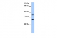 ARP53656_P050 - Galectin-8