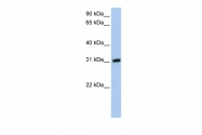 ARP53695_P050 - Dickkopf-like protein 1