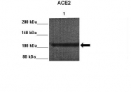 ARP53751_P050 - ACE2