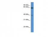 ARP53783_P050 - L-asparaginase
