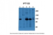 ARP53817_P050 - WDR10 / IFT122