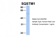 ARP54262_P050 - SQSTM1