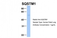 ARP54262_P050 - SQSTM1