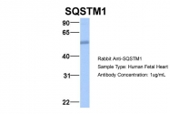 ARP54262_P050 - SQSTM1