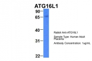 ARP54268_P050 - APG16L / ATG16L1