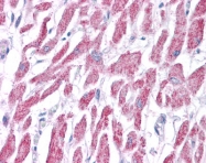 ARP54278_P050 - ACAT1 / MAT