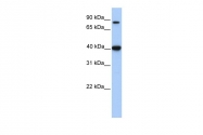 ARP54278_P050 - ACAT1 / MAT