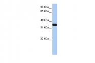 ARP54283_P050 - Apolipoprotein E / Apo E