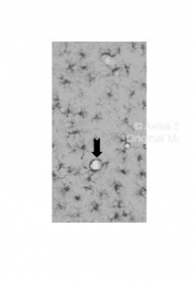 ARP54283_P050 - Apolipoprotein E / Apo E