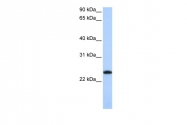 ARP54292_P050 - Ferritin light chain (FTL)
