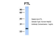 ARP54292_P050 - Ferritin light chain (FTL)
