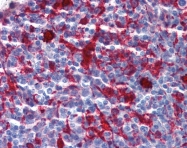 ARP54299_P050 - Gelsolin
