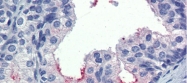 ARP54312_P050 - Anti-Muellerian Hormone / AMH