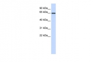 ARP54312_P050 - Anti-Muellerian Hormone / AMH
