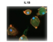 ARP54323_P050 - Interleukin-1 beta / IL-1B