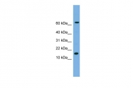 ARP54323_P050 - Interleukin-1 beta / IL-1B