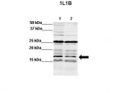 ARP54323_P050 - Interleukin-1 beta / IL-1B