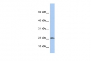 ARP54324_P050 - Interleukin-1 beta / IL-1B
